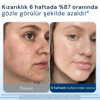 Lavrenza Clean Towels Makyaj Temizleme Ve Yüz Temizleme Havlusu